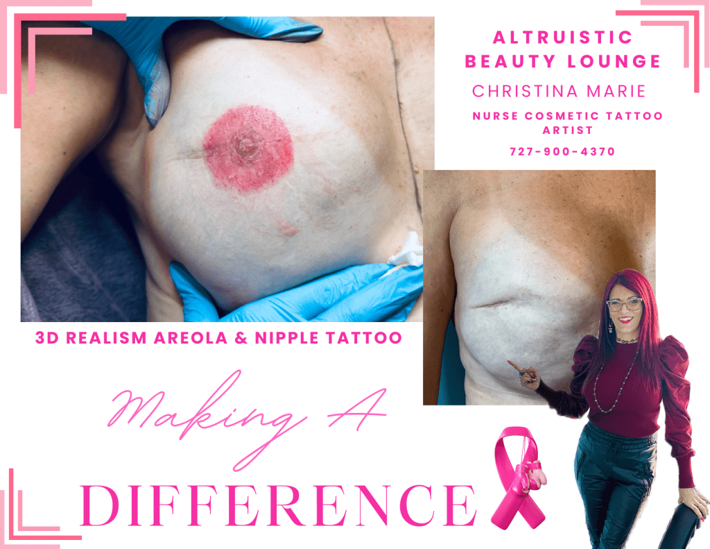 3D-Areola Cosmetic Tattoo Artist Training | Altruistic Academy ...